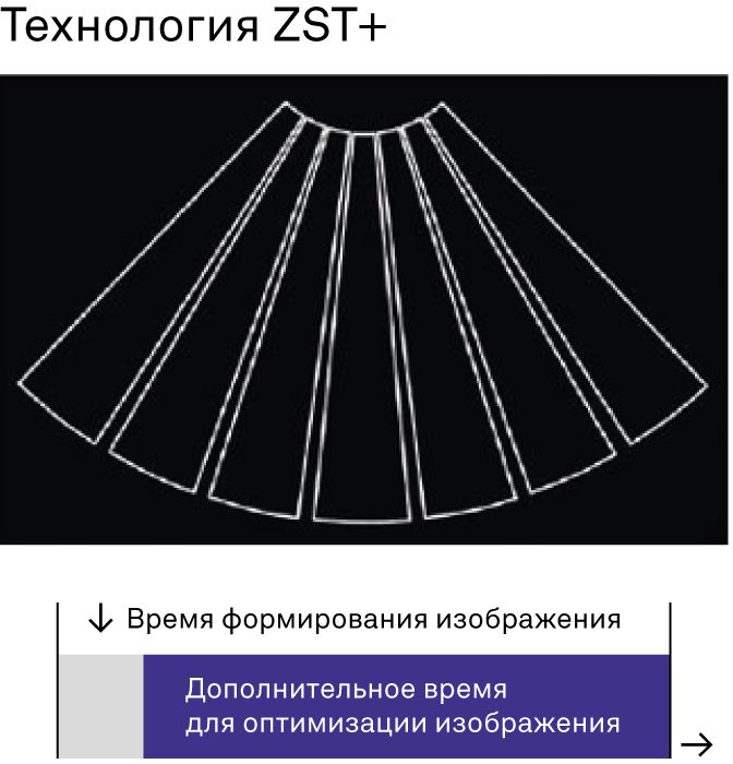 Технология ZST+