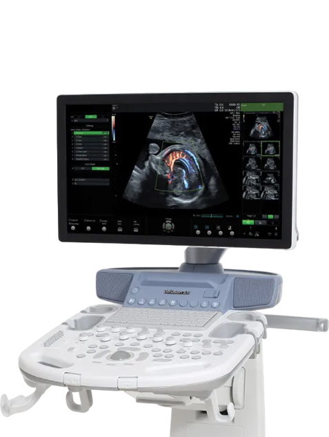 GE Healthcare Voluson S8