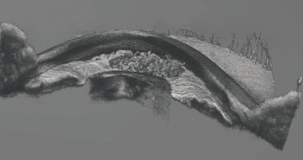 AS-OCTA и 3D OCT BMizar