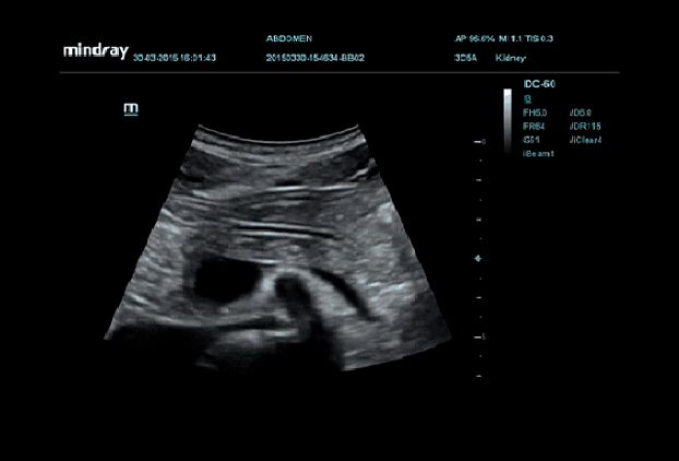 Smart OB