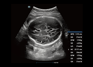 Smart OB