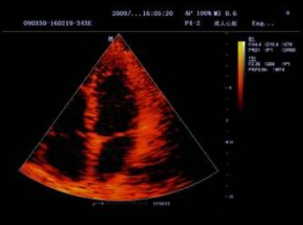 Tissue Doppler Imaging снимок 2