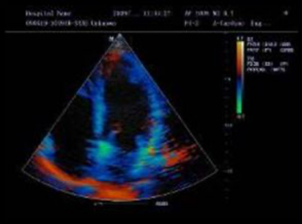 Tissue Doppler Imaging снимок 1