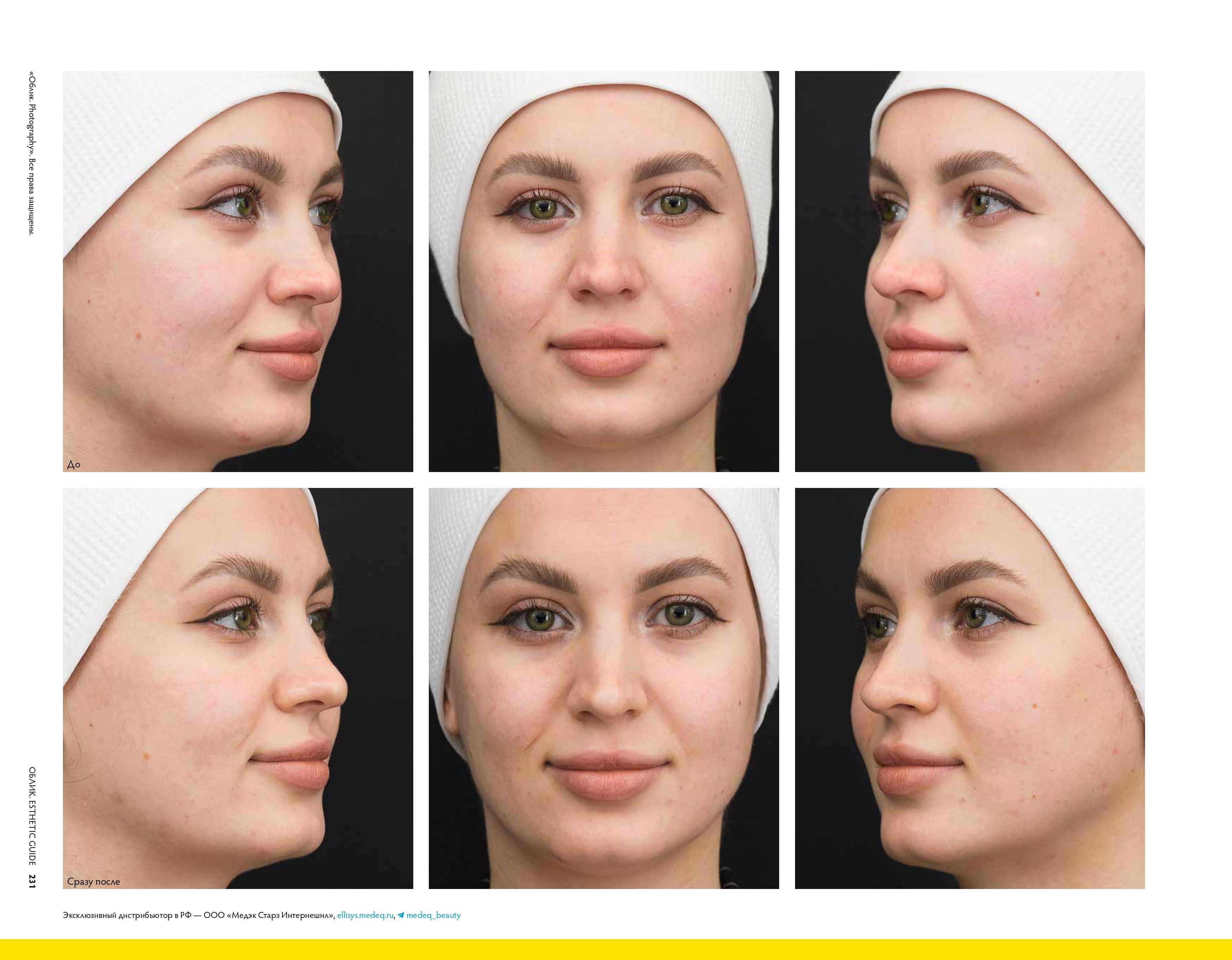 Облик. Full-face коррекция. Страница 6