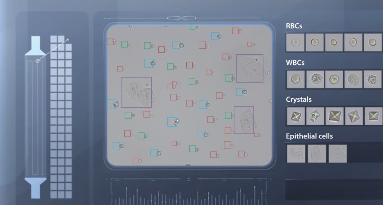 Подробный анализ осадка