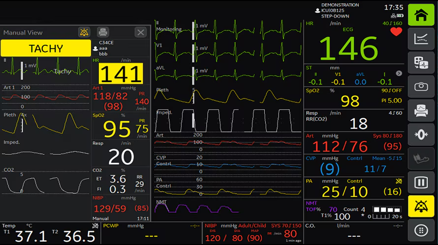 Режим bed-to-bed