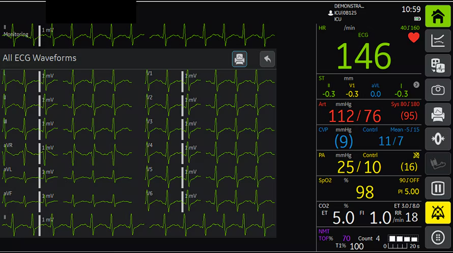 алгоритм EK-Pro v14