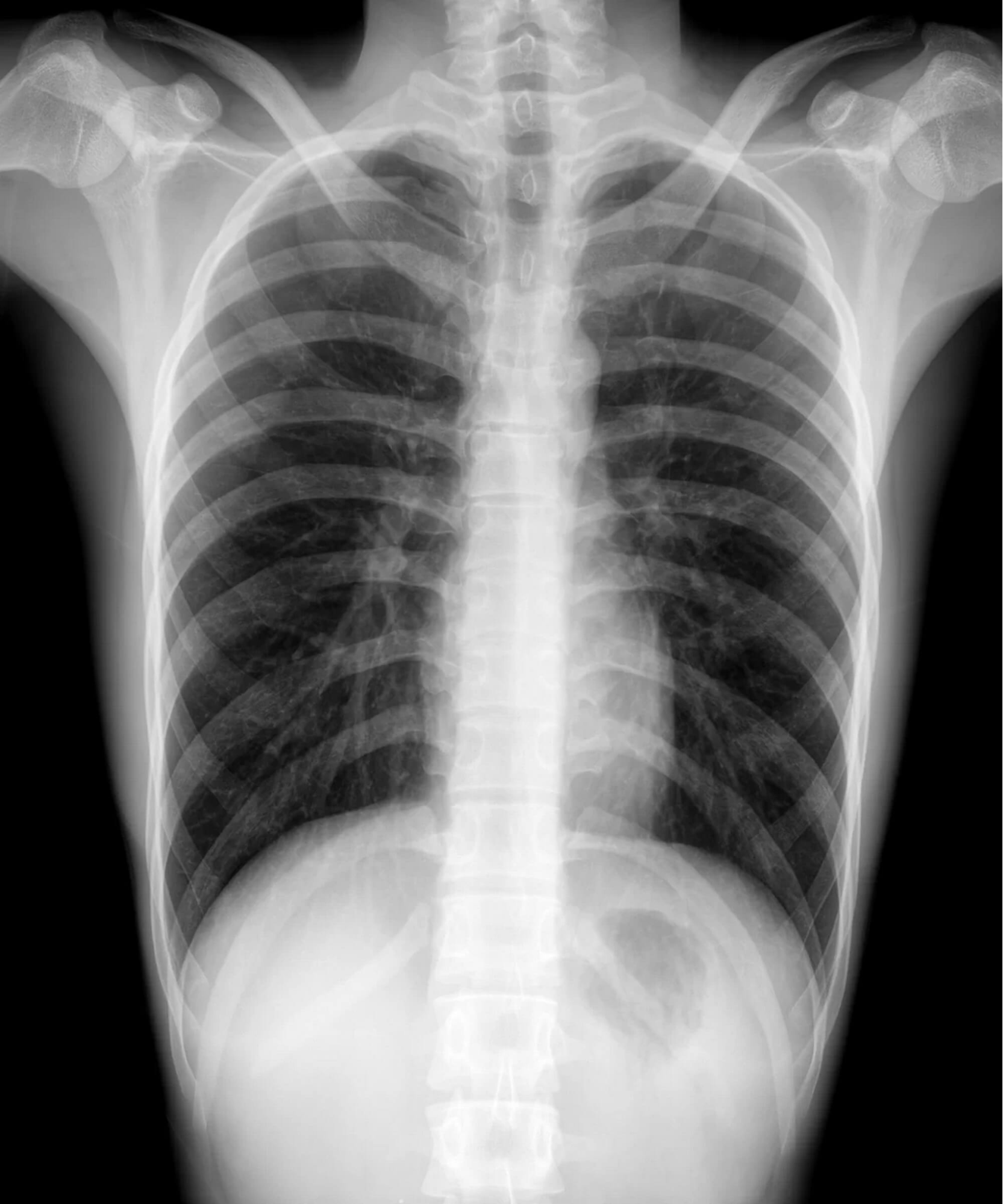 Алгоритм сшивки