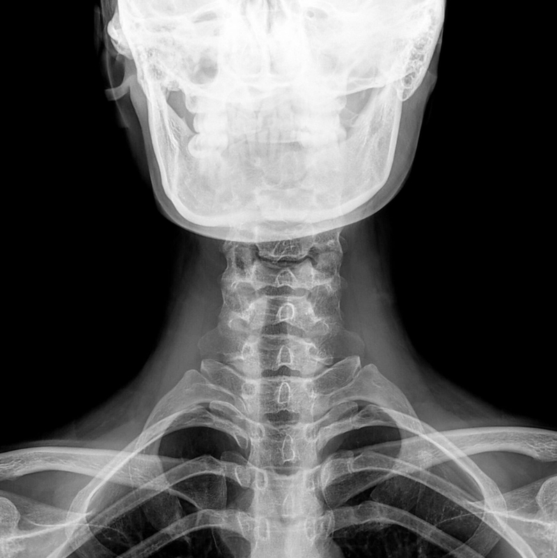 Высокое разрешение детектора и алгоритмы цифровой обработки