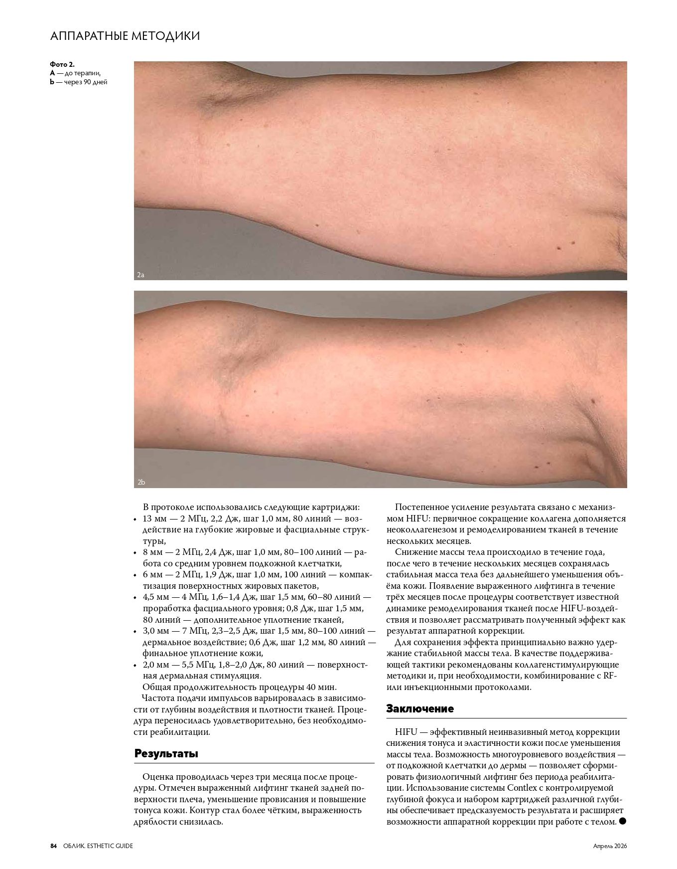 Contlex: предсказуемый лифтинг без повреждения кожи страница 4