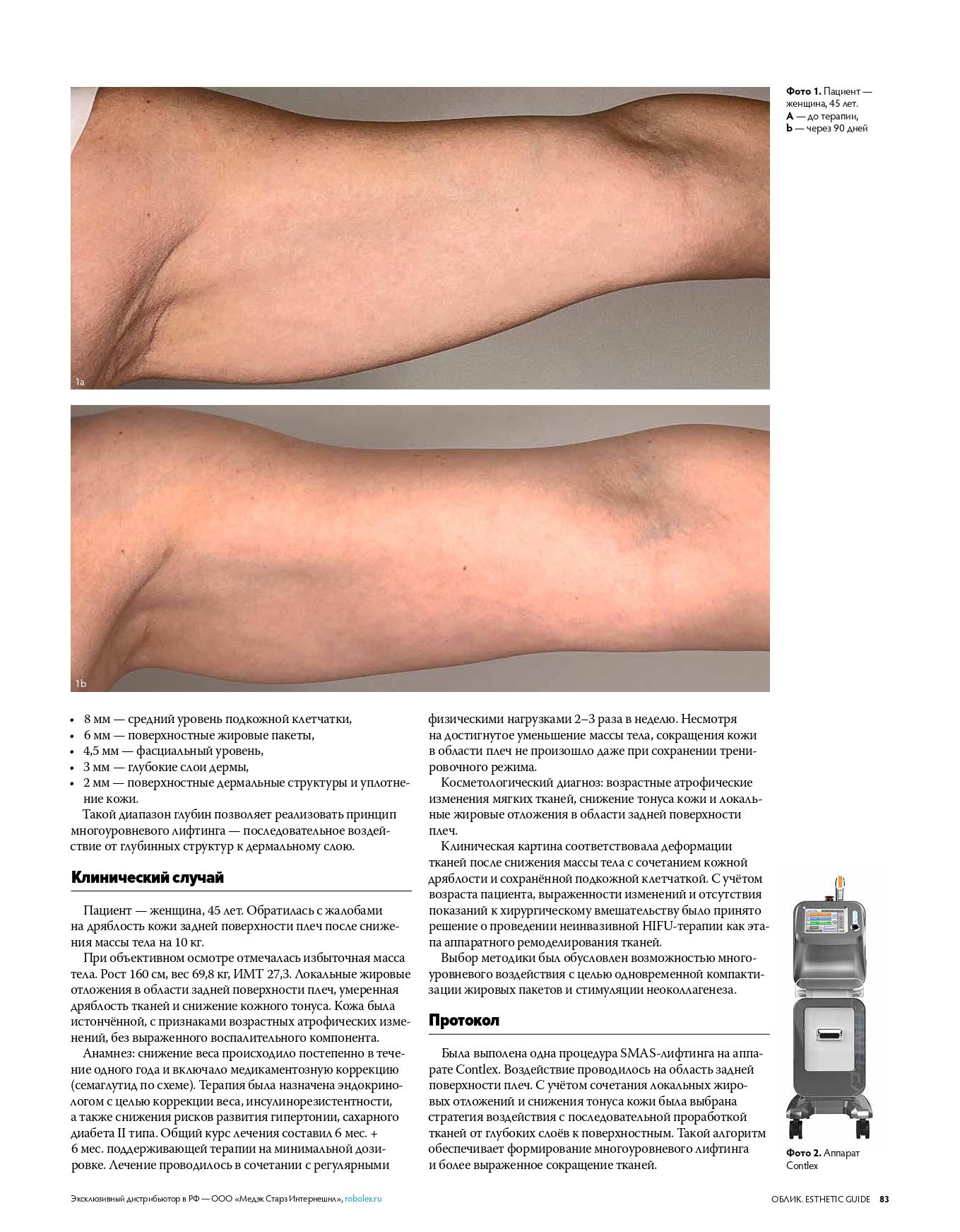 Contlex: предсказуемый лифтинг без повреждения кожи страница 3