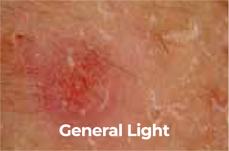 General light