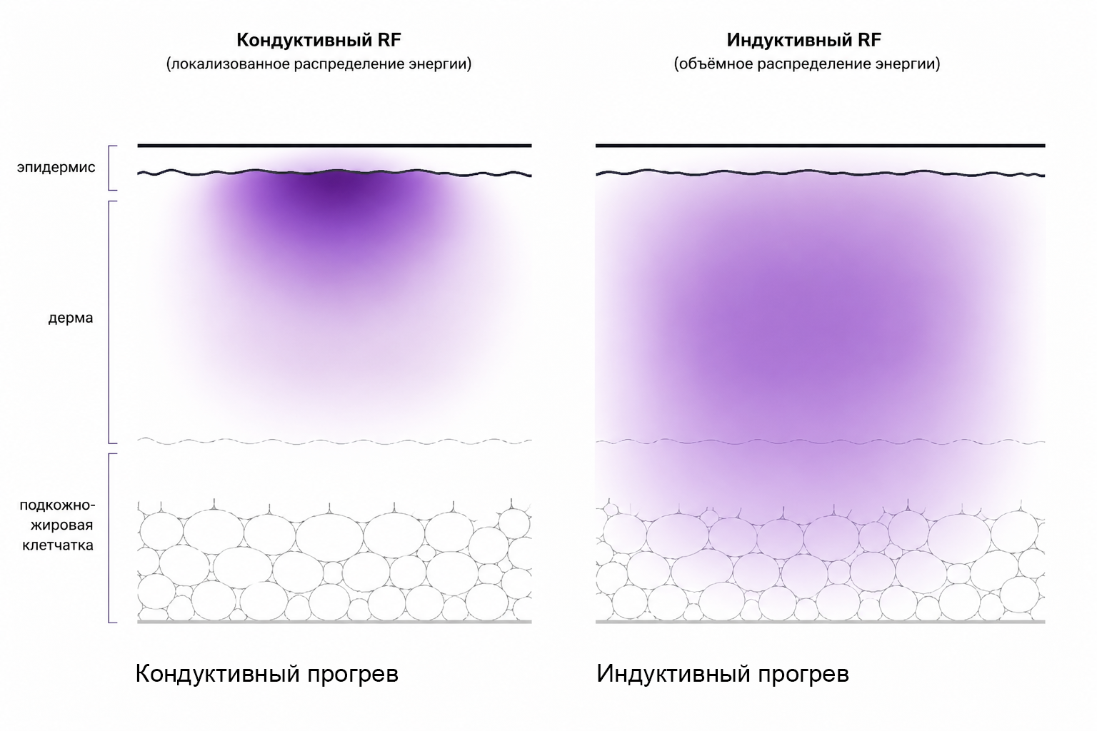 Кондуктивный прогрев
и Индуктивный прогрев