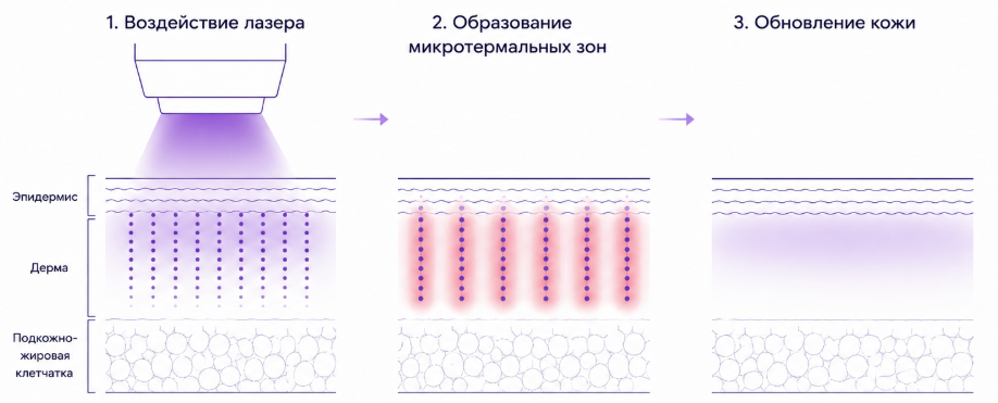 Экран статистического анализа результатов