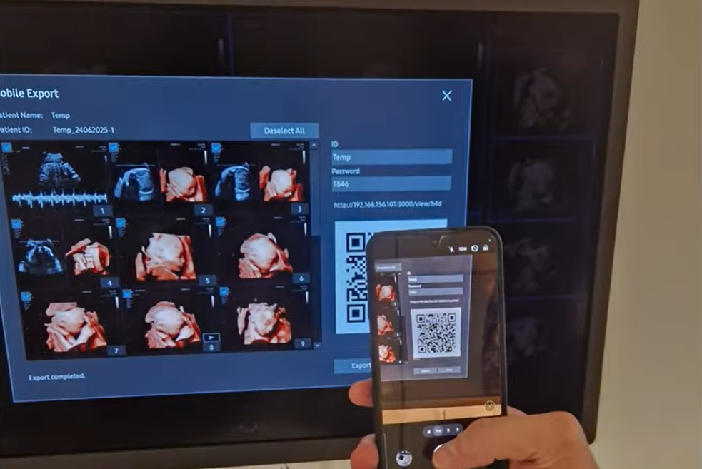 Mobile Export