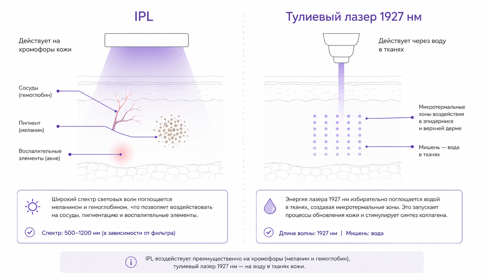 Сравнение IPL и тулиевого лазера