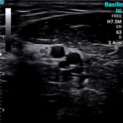 SonoTouch 30 (SonoEye)
