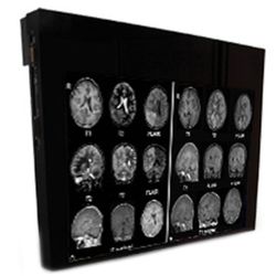 32″ MRSafe Display