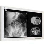 FS-P2607D
