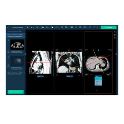 АПК «АрхиМед»