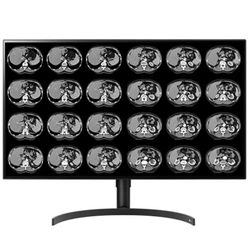 32″ Color 8MP Large Format Display