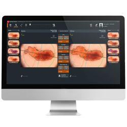 Moleanalyser Pro