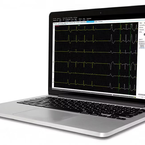 Стресс-система GE HealthСare CardioSoft, изображение 3