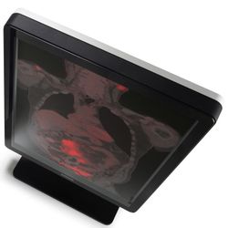 Nio Color 2MP LED MDNC-2221