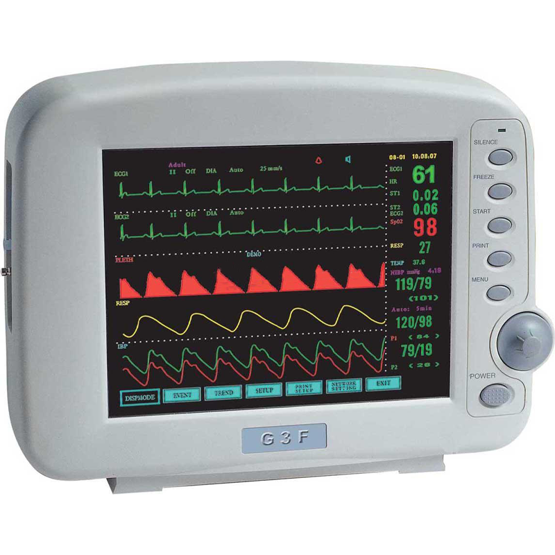 Мониторы прикроватные и реанимационные