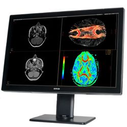 Coronis Fusion 6MP MDCC-6530