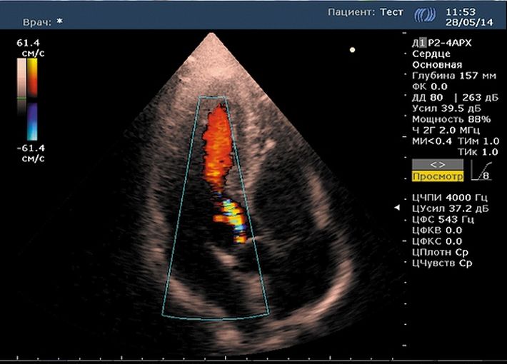 Соно/П-Ультра