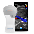 Vscan Air