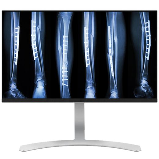27″ 8MP Color Clinical LED