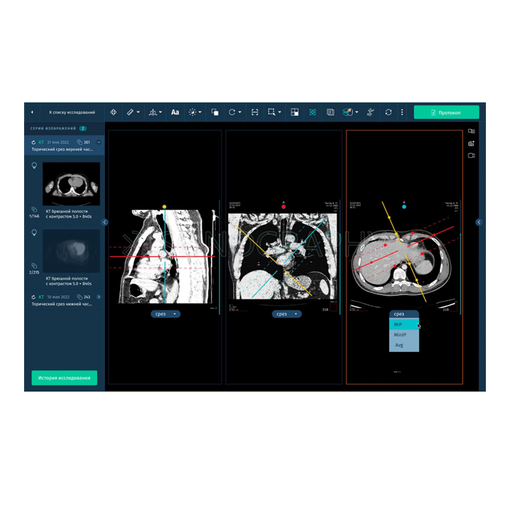 АПК «АрхиМед»