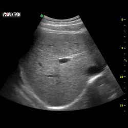УЗИ-экспертный класс