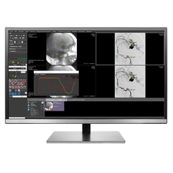 АРМ врача-диагноста "Гамма Мультивокс Д1"