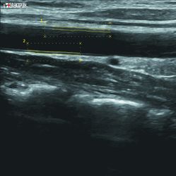 УЗИ-экспертный класс