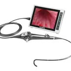 CY гибкий видеоцистонефроскоп