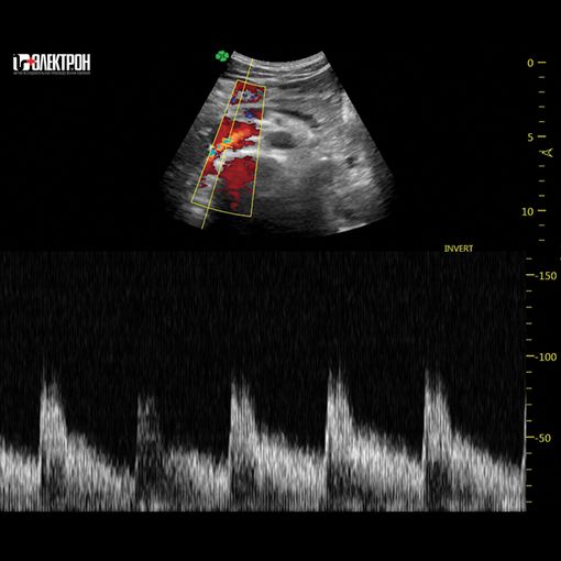 УЗИ-средний класс