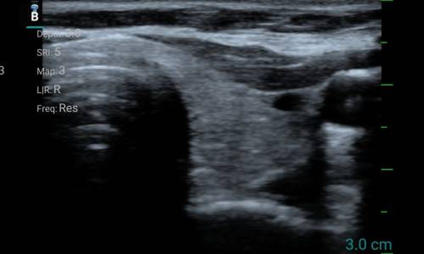 10SE (линейный)