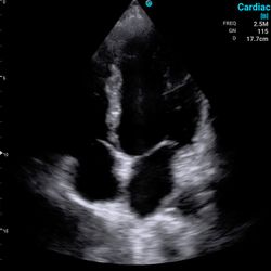 SonoTouch 30 (SonoEye)