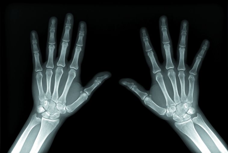 Цифровые аппараты с мобильным столом