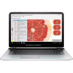 Компьютерная станция для кольпоскопической диагностики