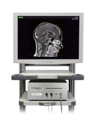 Хирургическая навигационная система