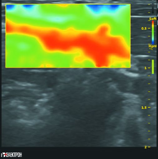 УЗИ-экспертный класс