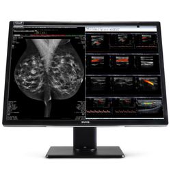 Nio Fusion 12MP MDNC-12130