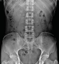 Гамма 2 рабочих места