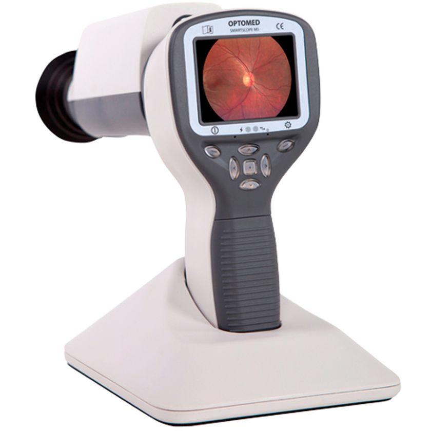 Smartscope M5