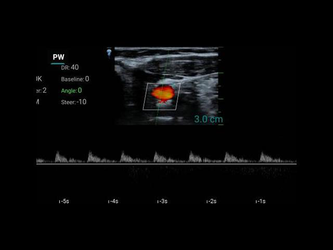 10SE (микроконвексный)