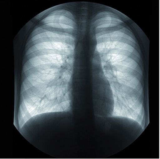Аналоговые аппараты на 2 и 3 рабочих места